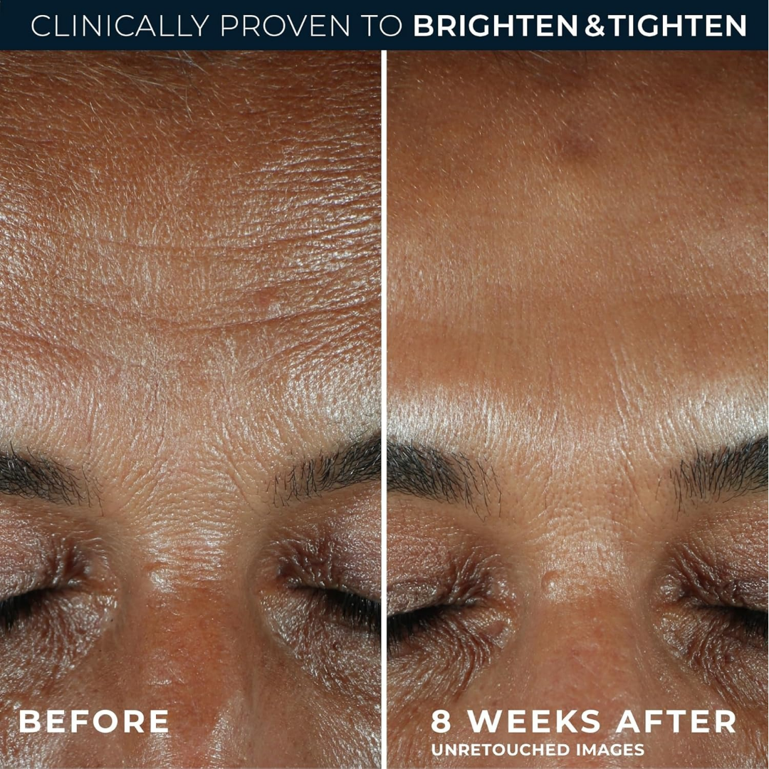 RoC Multi Correxion Revive + Glow Vitamin C Serum - Image 4